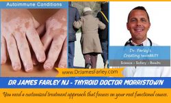 Dr James Farley NJ – Thyroid doctor Morristown