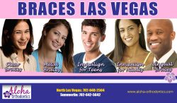 Braces Las Vegas