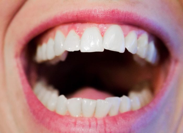 best invisalign orthodontist nyc | http://www.smilehealthspa.com/contact-us/