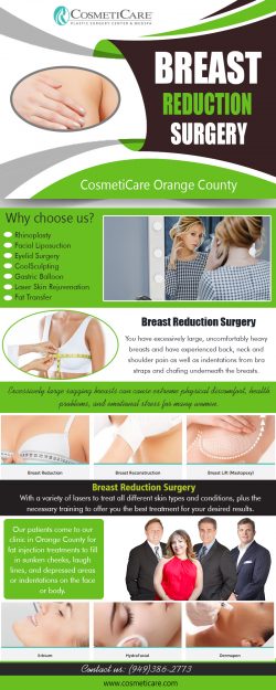 Breast Reduction Surgery