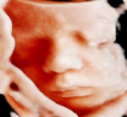 5d Ultrasound Melbourne