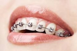 Dentist Bundoora – Emergency Dentistry | Dental Clinic Bundoora