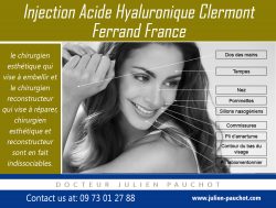 injection acide hyaluronique clermont ferrand france|http://www.julien-pauchot.com/