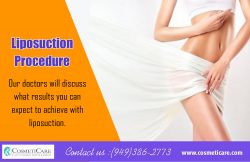 Liposuction Procedure