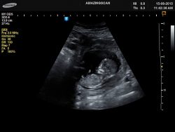 Ultrasound Melbourne