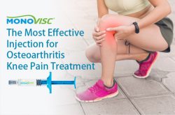 Monovisc – The Most Effective Injection for Osteoarthritis Knee Pain Treatment