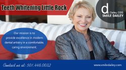 Teeth Whitening Little Rock