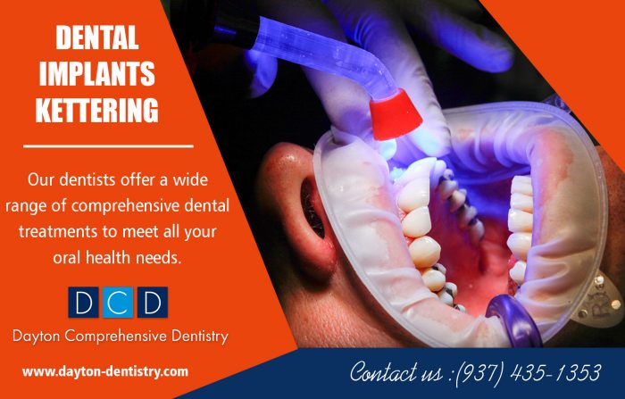 Dental Implants In Kettering