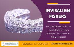 Invisalign Fishers | 3175968000 | fallcreekdentistry.com