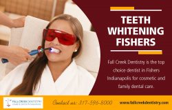 WhiteningTeeth Fishers | 3175968000 | fallcreekdentistry.com