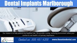 Dental Implants Marlborough