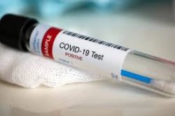 CE Marked COVID-19 test kit in UK