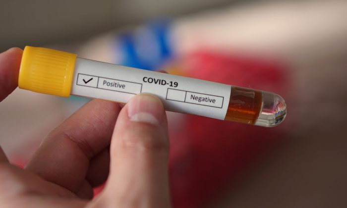 SARS-CoV-2 Antigen Rapid Test United Kingdom