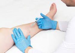 Vein Treatments North Shore | Board Certified Vein Treatment Experts Jericho