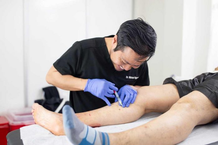 What Type of Doctor Treats Varicose Veins? And Other Vein-Related FAQs | Vein Treatment in Long  ...