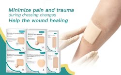 Using Foam Dressings to Improve the Quality of Chronic Wound Prevention and Treatment