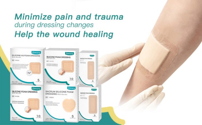 Using Foam Dressings to Improve the Quality of Chronic Wound Prevention and Treatment