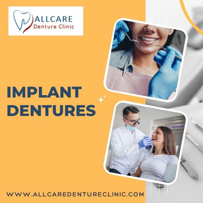 Finding an Affordable Implant Dentures Provider in Abbotsford