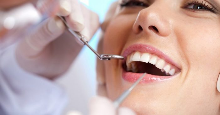 Expert Tooth Extraction Services in Christchurch