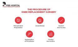 The Procedure of Knee Replacement Surgery