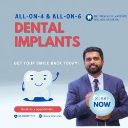 Dental implants chennai