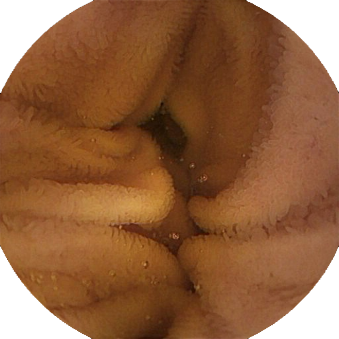 OMOM HD Capsule Endoscopy Platform