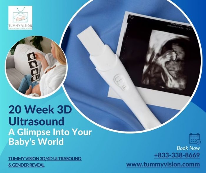 Journey into Joy: Embracing Change with 20 Week 3D Ultrasound