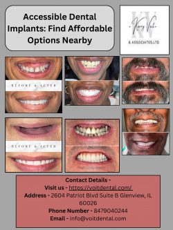 Accessible Dental Implants: Find Affordable Options Nearby