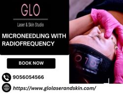 Achieve Radiant Skin through Microneedling with radiofrequency