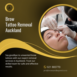 You want a qualified Brow Tattoo Removal Artist in Auckland