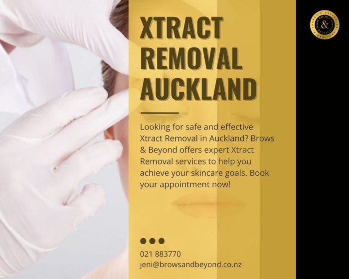 Our expert tattoo specialist can help you with your Xtract Removal Auckland