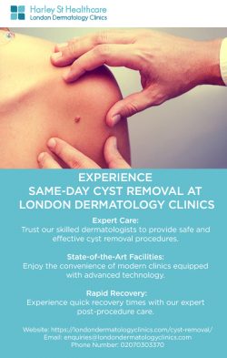 Experience Same-Day Cyst Removal at London Dermatology Clinics