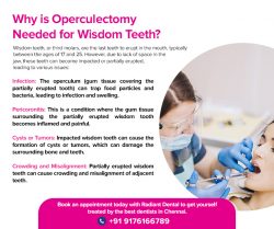 Why is Operculectomy Essential for Wisdom Teeth?