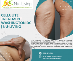Cellulite Treatment Washington DC | Nu-Living