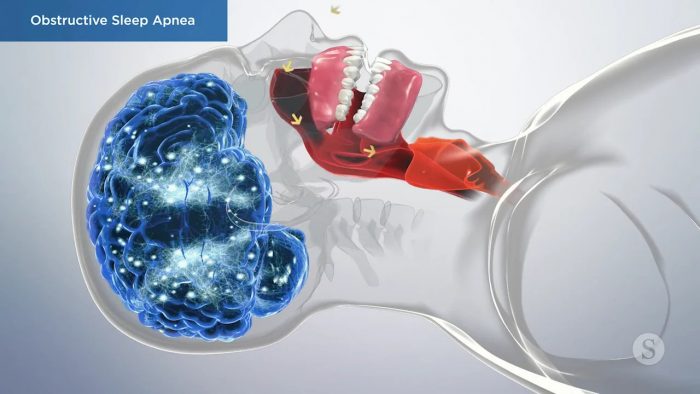 Sleep Apnea Dentistry Near Me In Houston