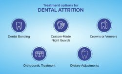 Treatment options for Dental Attrition