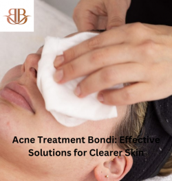 Acne Treatment Bondi: Effective Solutions for Clearer Skin