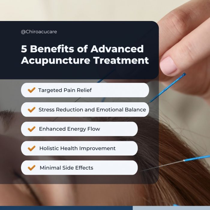 The Benefits of Advanced Acupuncture Treatment