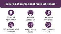 Advantages of Professional Teeth Whitening