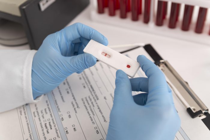 What is the 4th Generation Rapid HIV Test?