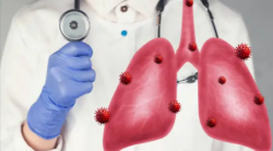 Lung Transplant Cost in India: Quality Treatment at Lower Price | HOSPIDIO