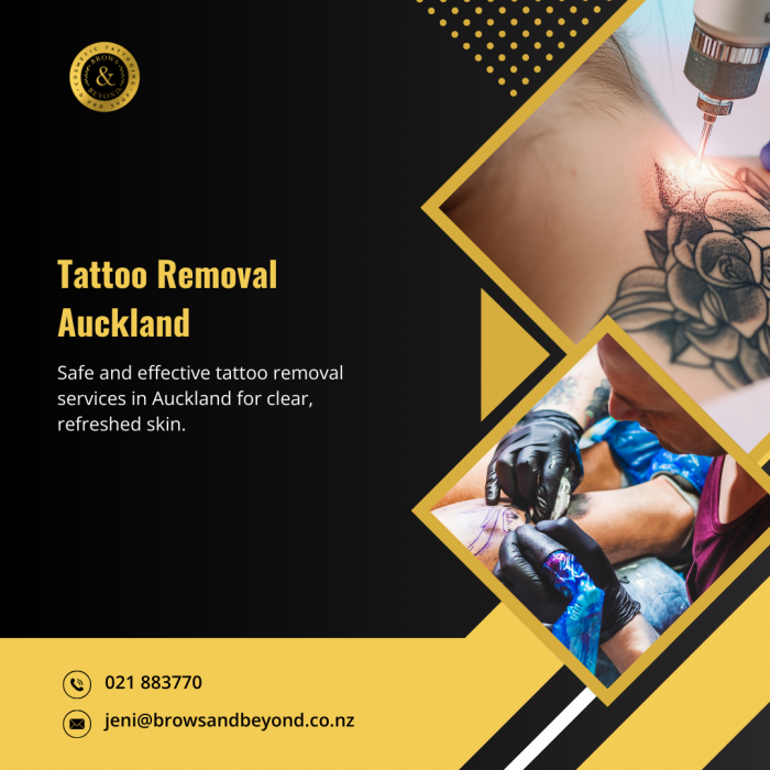 Visit our clinic for professional and affordable Tattoo Removal Auckland