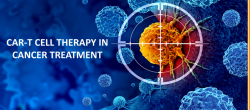 CAR T-Cell Therapy cost in India | HOSPIDIO