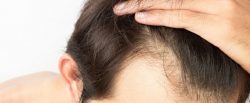 Hair Specialist in Ghaziabad