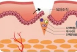 Effectively Use OEM Acne patches