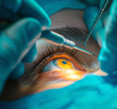 How Can Desserts Benefit Eyelid Surgery Recovery?