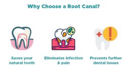 Painless Root Canal Cost in Mumbai