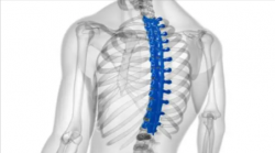 Affordable Scoliosis Surgery Cost in India – Expert Treatment – HOSPIDIO