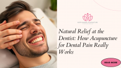 Natural Relief at the Dentist: How Acupuncture for Dental Pain Really Works