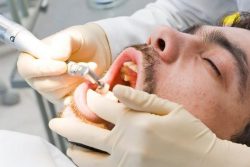 Sedation Dentistry